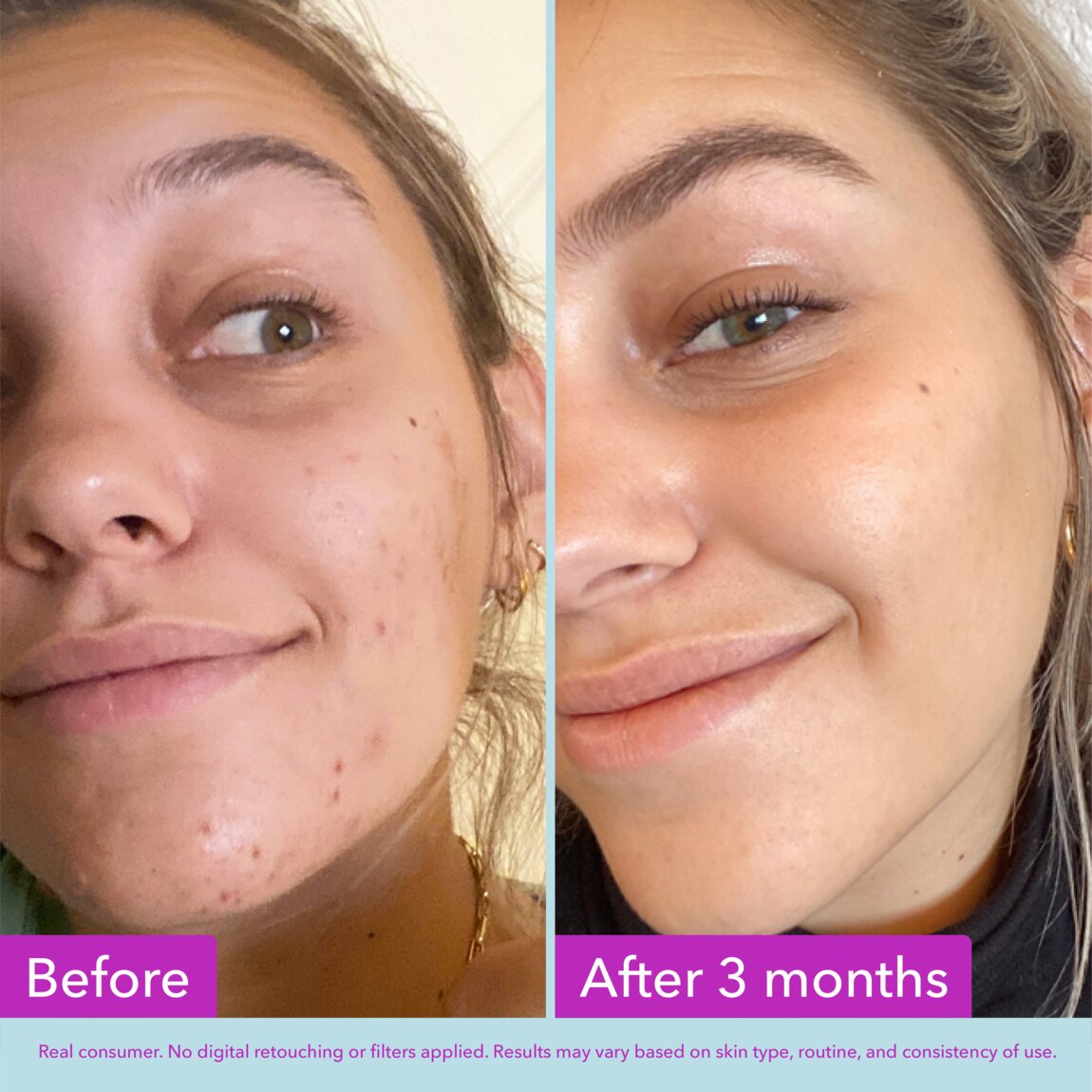 niacinamide-brightening-toner-e6 zb_p.jpg